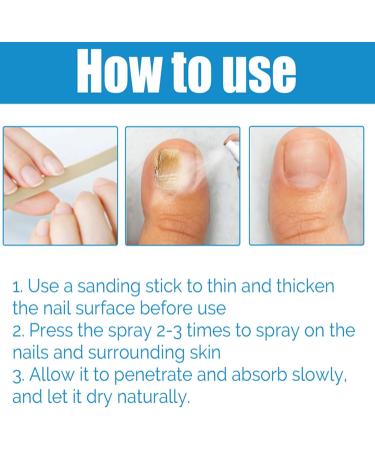 WJnflQN Nail StrengtheningFoot Nail Nourishing Spray 100ml Nonsticky Strengthening Spray for Damaged Cracked Brittle Nails for Daily Hand and Foot Care - Buy Online on GoSupps.com