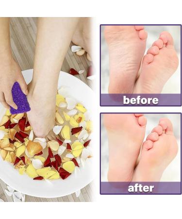 10 Pcs Pumice Stone for Feet Foot Pumice Stone Scrubber Pedicure Double Sided Exfoliation Suitable Double Sided Foot Scrub Foot Stone Ideal Suitable for Home and Beauty Salons(Yellow Purple) - Buy Online on GoSupps.com