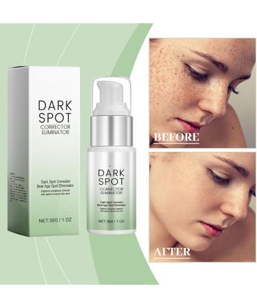 Dark Spot Remover for Face - Repair Face Cream - Face Cream for Women - Face Moisturiser for Dark Spot Correcting - Moisturizing and Anti-Blemish Spot Cream (30g) - Buy Online on GoSupps.com
