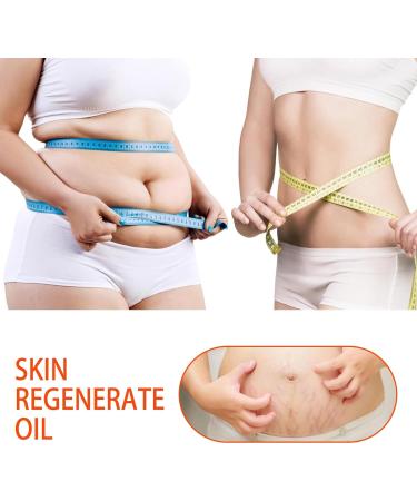 Optimal Oil Stretch Mark Oil Body Oil for Women Stretch Marks Removal Body Oil Collagen Boost Firming & Lifting Skincare Oil Anti Stretch Mark Cream Pregnancy Nuture Nourishing Skin Treatment Oil - Buy Online on GoSupps.com