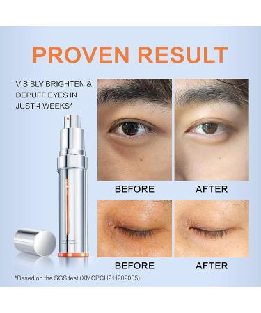 PROYA Brightening Youth Activating Eye Cream - Dark Circles & Puffiness 0.71 oz - Buy Online on GoSupps.com