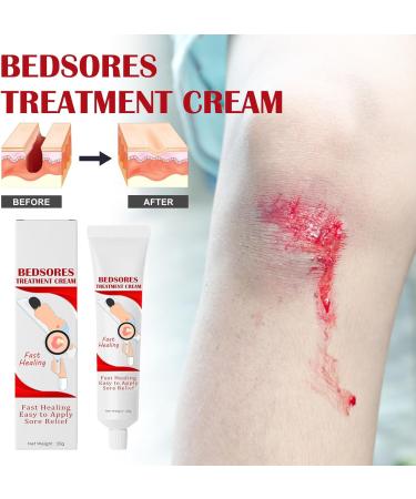 G n rique Bedsore Treatment Cream Fast-Acting Bedsor Cream 20g Soothing Relief for Bedsores Fast Healing Improves Elasticity and Repairs Damaged Skin - Buy Online on GoSupps.com