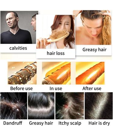  Vawolecy Ginger Shampoo for Hair Growth - Deep Cleansing for Hair and Scalp Loss - Organic Rice Shampoo - Promotes Growth Control - Buy Online on GoSupps.com
