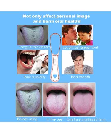 Faruta Tongue Scraper for Adults & Kids | Reusable Tongue Cleaner Tool | Eliminates Bad Breath & Promotes Oral Hygiene - Buy Online on GoSupps.com