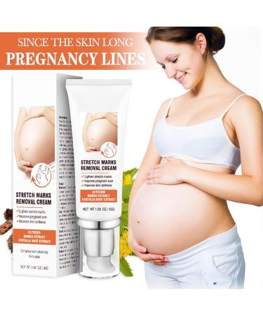 Remove Stretch Marks Cream | Body Repair Cream with Centella Glycerol for Women | Post-Pregnancy Stretch Mark Reduction | 45g - Buy Online on GoSupps.com