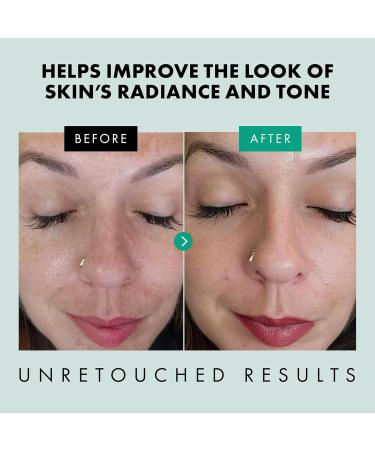 Eclat Skincare Vitamin C Serum + Clarifying Niacinamide Serum Bundle Brightening Hydrating & Anti Aging Duo Dark Spot Reduction Pore Refining & Skin Radiance 2 x 1 Fl Oz - Buy Online on GoSupps.com