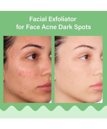 Peeling Gel & Aloe Vera Exfoliator - Brightening Facial Scrub & Deep Cleansing Face Wash for All Skin Types | Remove Dead Skin & Refresh After Sun Care - Buy Online on GoSupps.com