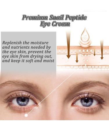 KOAHDE Snail Moisturizing Eye Cream Remove Dark Circles Eye Cream Remove Eye Wrinkles Cream Black Circle Removing Eye Cream Magic Eye Cream Eye Cream Remove Eye Wrinkles Remove Eye Bags Eye Cream 17ML - Buy Online on GoSupps.com
