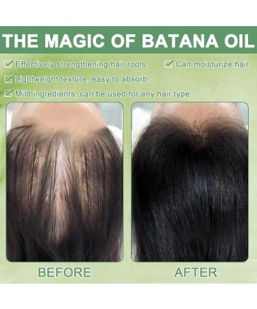 Batana Oil Batana Oil for Hair Pure Batana Oil Batana Oil for Hair Contains 100% Batana Oil Batana Oil for Hair Makes Hair Thicker (100G) - Buy Online on GoSupps.com
