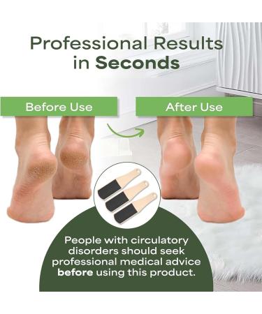 SSKHE 3 Pieces Double Sided Foot File U-shaped sole file Professional Foot Rasp Hard Skin Remover Foot Rasp File for Hard Skin Removal Restore smooth soles of feet(khaki) - Buy Online on GoSupps.com