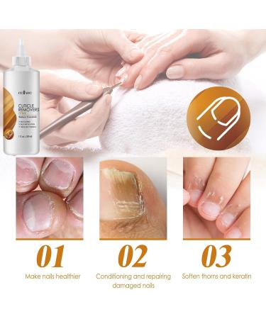 Cuticle Remover Cream Nail Cuticle Remover Gel Cuticle Oil for Nails Cuticle Care Gel Cuticle Remover Liquid Nail Treatments Cuticle Softener and Remover Nail Oil Cuticle Pen Instant Cuticle Remover - Buy Online on GoSupps.com