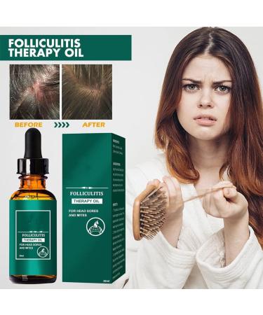 rongweiwang Hair Growth Essential Oil Natural Ingredient Regrowth Moisturizing Nourishing Essence Haircare Serum Beauty Supplies - Buy Online on GoSupps.com