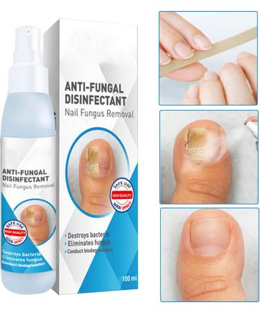 WJnflQN Nail StrengtheningFoot Nail Nourishing Spray 100ml Nonsticky Strengthening Spray for Damaged Cracked Brittle Nails for Daily Hand and Foot Care - Buy Online on GoSupps.com