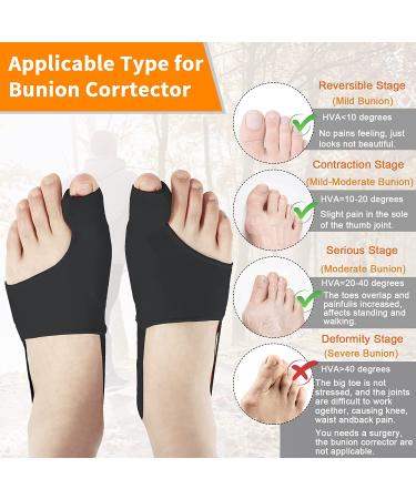 Bunion Corrector for Women & Men - Non-Surgical Bunion Splints with Toe Separators - Effective Hallux Valgus Correction - Day/Night Wear - Black - Buy Online on GoSupps.com