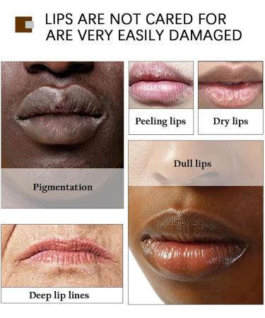 Pink Lip Lightening Treatment Lip Moisturizer Lips Fast Whitening Treatment Dark Lightening Lips Pink Cream Lip Butters Lip Makeup (1pc) - Buy Online on GoSupps.com