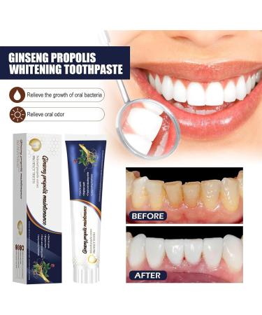 Ginseng Propolis Whitening Toothpaste Stain Removal & Fresh Breath (3 pcs) | Natural Tooth Care for Loose Teeth - Buy Online on GoSupps.com