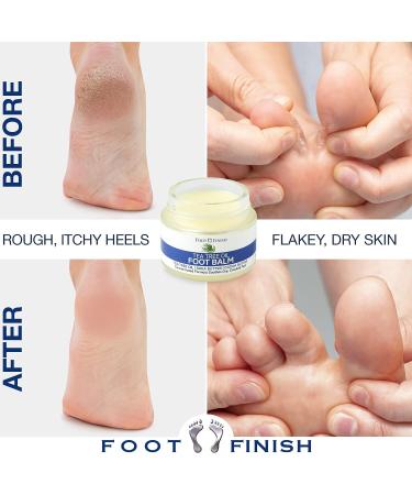 LOVE LORI Foot Balm for Dry Cracked Feet - Tea Tree Oil Cream for Athletes Foot Treatment - Moisturizing Heel Balm & Repair Cream - Dry Feet Treatment for Women | Foot Finish - Buy Online on GoSupps.com