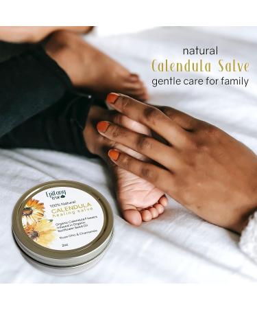 Epifany True 100% Natural Calendula Salve 2oz | Soothing Balm for Dry Skin, Eczema, Rashes, Bruises, Bug Bites | Organic Beeswax | Itch Relief - Buy Online on GoSupps.com