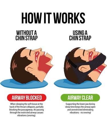 Anti Snoring Chin Strap for CPAP Users | Aveela Anti Snore Device | Multiple Sizes for Men and Women | Comfortable & Adjustable | Reduce Snoring and Dry Mouth - Buy Online on GoSupps.com