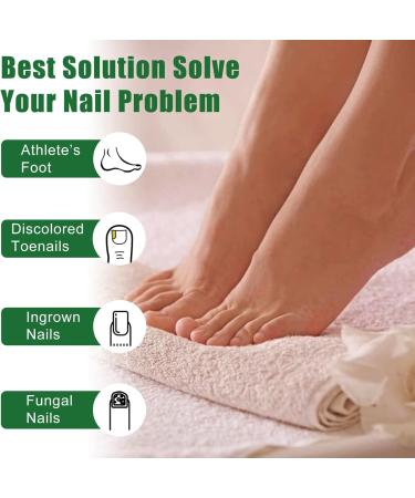Antifungal Nail Treatment for Toe Fungus - 2-in-1 Solution to Treat and Prevent Nail Fungal Infections - Buy Online on GoSupps.com