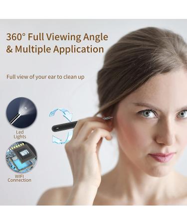 Ear Cleaner Otoscope with Light - Wireless Ear Camera for iPhone & Android - Ear Wax Removal Kit with 6 Tools - Buy Online on GoSupps.com
