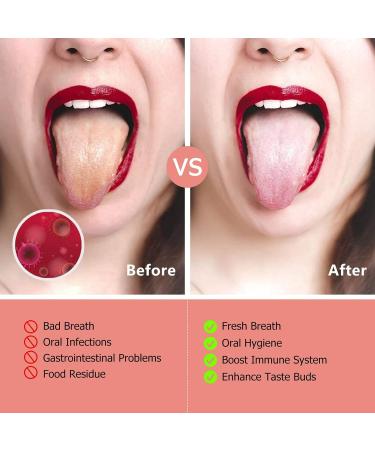 Healifty Stainless Steel Tongue Scraper 3Pcs Set with Storage Case - Rose Gold Pink Tongue Cleaner for Fresh Oral Breath - Buy Online on GoSupps.com