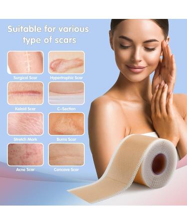 Silicone Scar Sheets 1.6x120 Tape Roll - Keloid & Surgical Scar Removal Treatment - Buy Online on GoSupps.com
