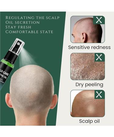  Zegaqae Scalp Care Cream | Nourishing Spray for People Suffering from Hair Loss Moisturizes and Hydrates Dry Hair for Daily Care Dad Grandad Male Colleague - Buy Online on GoSupps.com