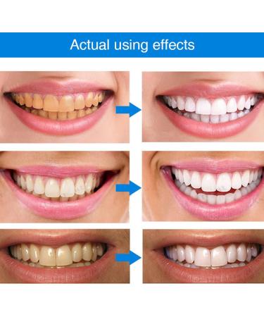 Buy 2-Piece Gum Therapy Gel for Effective Periodontal Treatment | Brightening Tooth Health Gel - Buy Online on GoSupps.com