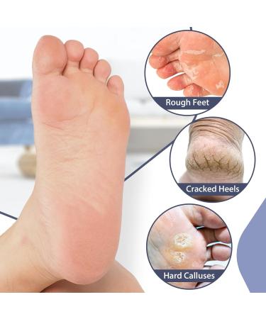 Shop No Lifting X-Large Reusable Silicone Moisturizing Socks for Dry Skin | Non-Slip Spa Socks for Men - Pink & Tan - Buy Online on GoSupps.com