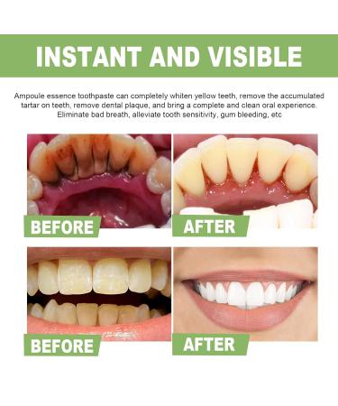 Rtioa Ampoule Toothpaste - Tartar Removal & Whitening with 3V Fruit Acid (2 Boxes) | Eco-Friendly International Shipping - Buy Online on GoSupps.com