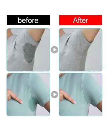 2pcs Spray Deodorant for Women and Men - Long Lasting Freshness for Both Genders - Buy Online on GoSupps.com