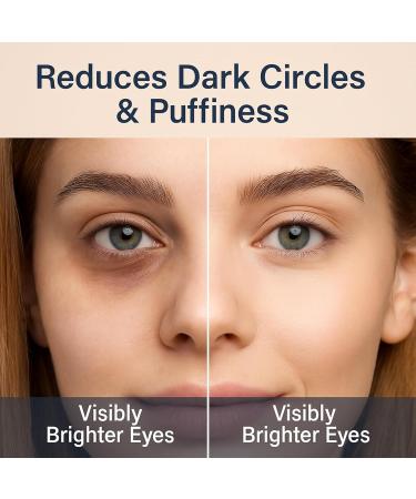  Nuvilo Retinol eye cream with hyaluronic acid under-eye care for dark circles puffiness and fine lines anti-aging wrinkle cream firming and moisturizing treatment for women & men (4 pcs) - Buy Online on GoSupps.com