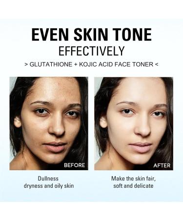 Kojic Acid Toner for Face - Face Toner Dark Spot Remover for Face Acne Toner Hydrating Toning Solution Even Skin Tone Korean Toner Skincare Exfoliating Toner for All Skin 118ml - Buy Online on GoSupps.com