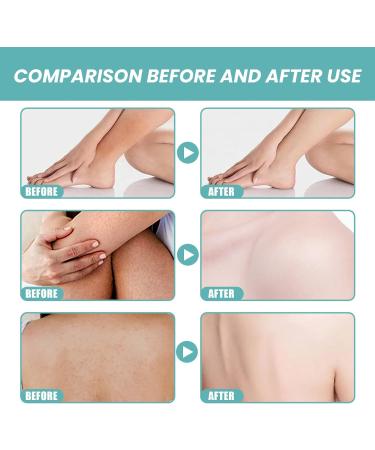 Body Shower Oil Women's Skin Care Shower Oil Women's Brightening Shower Oil Body Care Moisturizing Essence Oil to Smooth and Soften Dry or Rough Skin - Buy Online on GoSupps.com