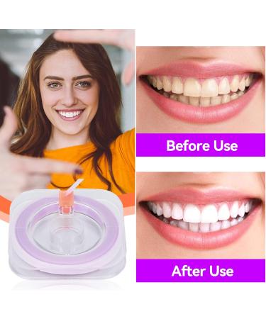 Dental Polishing Strips 50um - Teeth Abrasive Finishing Tool for Deep Cleaning - Oral Care - Buy Online on GoSupps.com