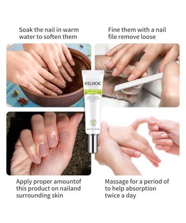 Yueci Hand & Foot Care Cream - Heal Cracked Nails & Toenails | Nail Repair Treatment (2PCs) - Buy Online on GoSupps.com