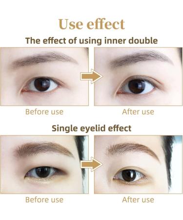 Invisible Eyelid Lifter Strips Kit Self-Adhesive Double Eyelid Tapes with Fork Rod Tweezer for Hooded Droopy Mono-eyelids 300 Pairs Eyelid Lifter Strips - Buy Online on GoSupps.com