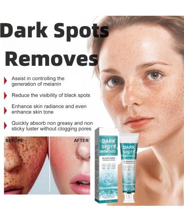 Fade Stain Beauty Cream Freckle Remover Cream Dark Spot Remover for Face Dark Spot Correcting Glow Serum Dark Spots Remover Dark Spot Corrector Cream Age Spot Remover Dark Spot Cream Spot Remover - Buy Online on GoSupps.com
