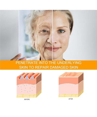 Quatrel Beauty Crema De Ojos Con P Ptidos 5d Crema De Ojos Con Peptido 5d Peptidos Eye Cream Anti Aging For Dark Circles And Puffiness Skin Under Eyes Moisturize (2pcs) - Buy Online on GoSupps.com