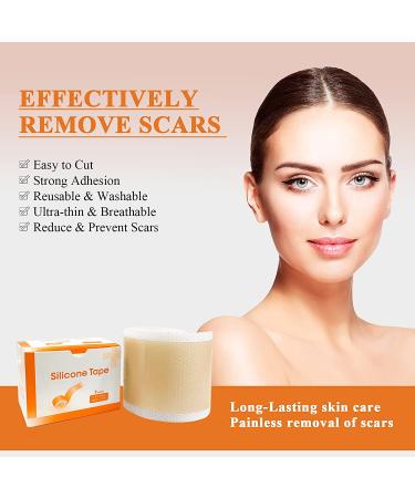 Carbou Medical Silicone Scar Tape Roll - 1.6â€‌ x 60â€‌ Scar Treatment & Wound Dressing - Buy Online on GoSupps.com