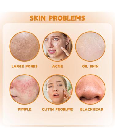 Hydrating Serum - Vitamin C Serum for Face - Hyaluronic Acid Serum for Face - Skin Care Face Serum - Dark Spot Correcting Glow Serum - Anti Aging & Wrinkle Vitamin C Serum - Face Serum for Women - Buy Online on GoSupps.com
