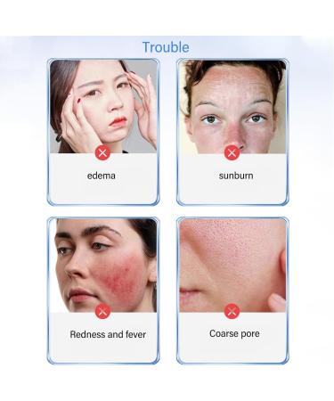 Compact Pore Ice Roller for Face Shrinkage Cold Compress for Rapid Absorption - Buy Online on GoSupps.com