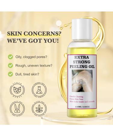 Chemical Peel for Face - Peeling Oil for Facial & Body Exfolianting with 16% Salicylic Acid - Dead Skin Remover with Gentle Formula for All Skin Type - 110mL(3.66OZ) - Buy Online on GoSupps.com