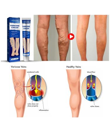 Moon Cheese Care Foot Relief Serum 1 Fl Oz - Promotes Smooth Skin and Blood Circulation - Buy Online on GoSupps.com