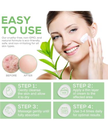 Urea Foot Cream Urea Cream 40 Percent for feet with Hyaluronic Acid Tea Tree and Aloe Vera for Deep Moisture Urea Cream for Feet Hands Heels Elbows Nails and Knees - Buy Online on GoSupps.com