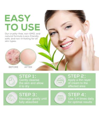 40% Urea Cream with 2% Salicylic Acid - Intensive Foot Cream for Dry Cracked Skin - Aloe Vera & Tea Tree - Exfoliates Dead Skin - 4.2 oz - Buy Online on GoSupps.com