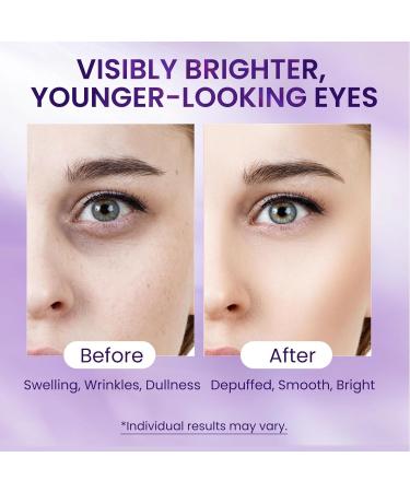 Caffeine & Retinol Under Eye Serum Dermatologist-Tested Fast Absorbing Correction for Puffy Eye Bags Fine Lines Dark Circles Wrinkles While Providing Moisturizing Care Vintage Violet - Buy Online on GoSupps.com