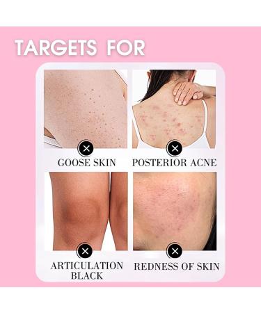 Sugar Face Scrubs Glow Exfoliator Sugar Scrub Body Exfoliator Exfoliating Body Scrubs Strawberry Sugar Face Exfoliator Facial Scrub Gently Removes Dead Skin Softer & Smoother Skin - Buy Online on GoSupps.com
