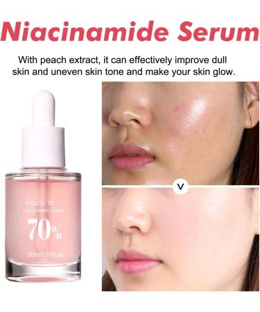 KOAHDE 70% Niacinamide Serum Anti-Aging Face Serum with Peach Extract Brightening Hydrating Face Glow Serum Face Moisturiser Anti-Aging Face Serum Peach Essence 70% Niacinamide Serum 30ML - Buy Online on GoSupps.com